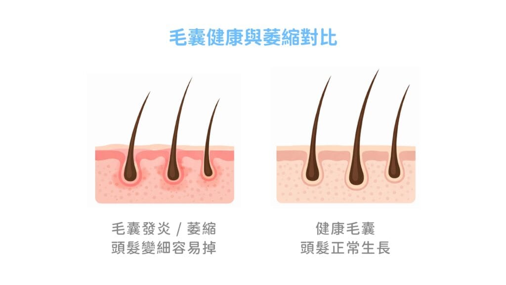 毛囊健康與萎縮對比