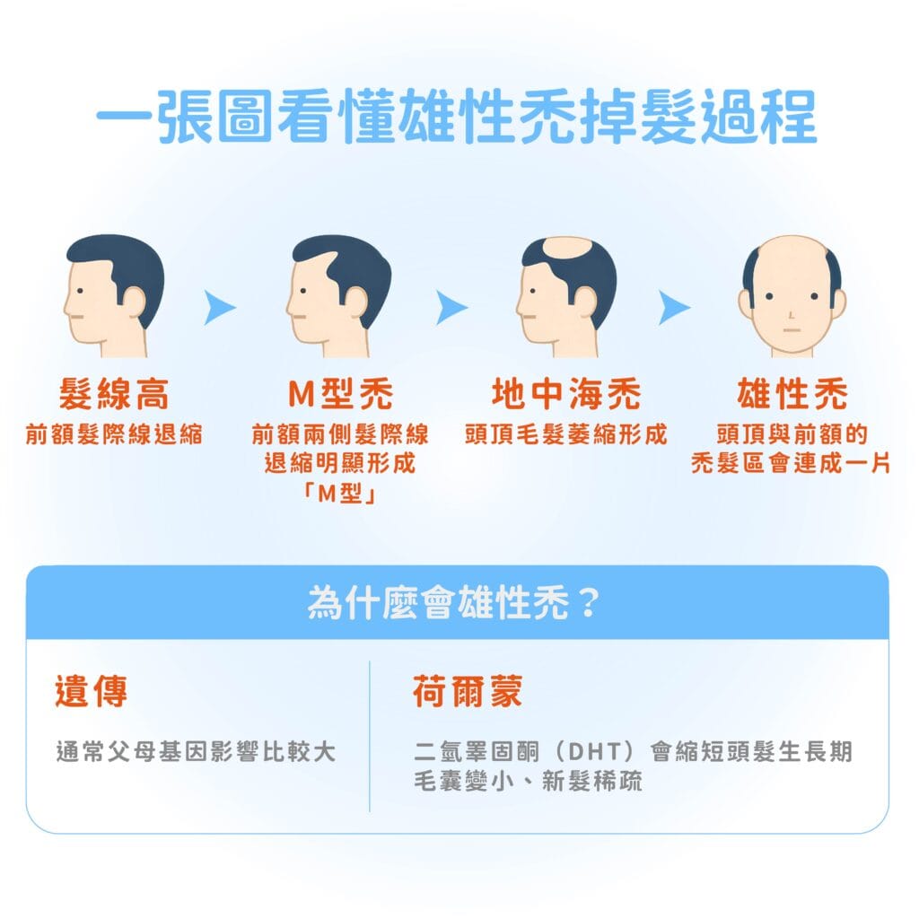 掉髮前兆 細毛與粗毛差異