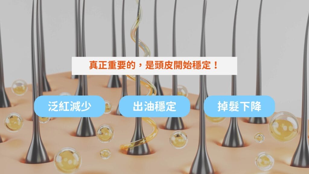 頭皮保養改善出油與掉髮狀況