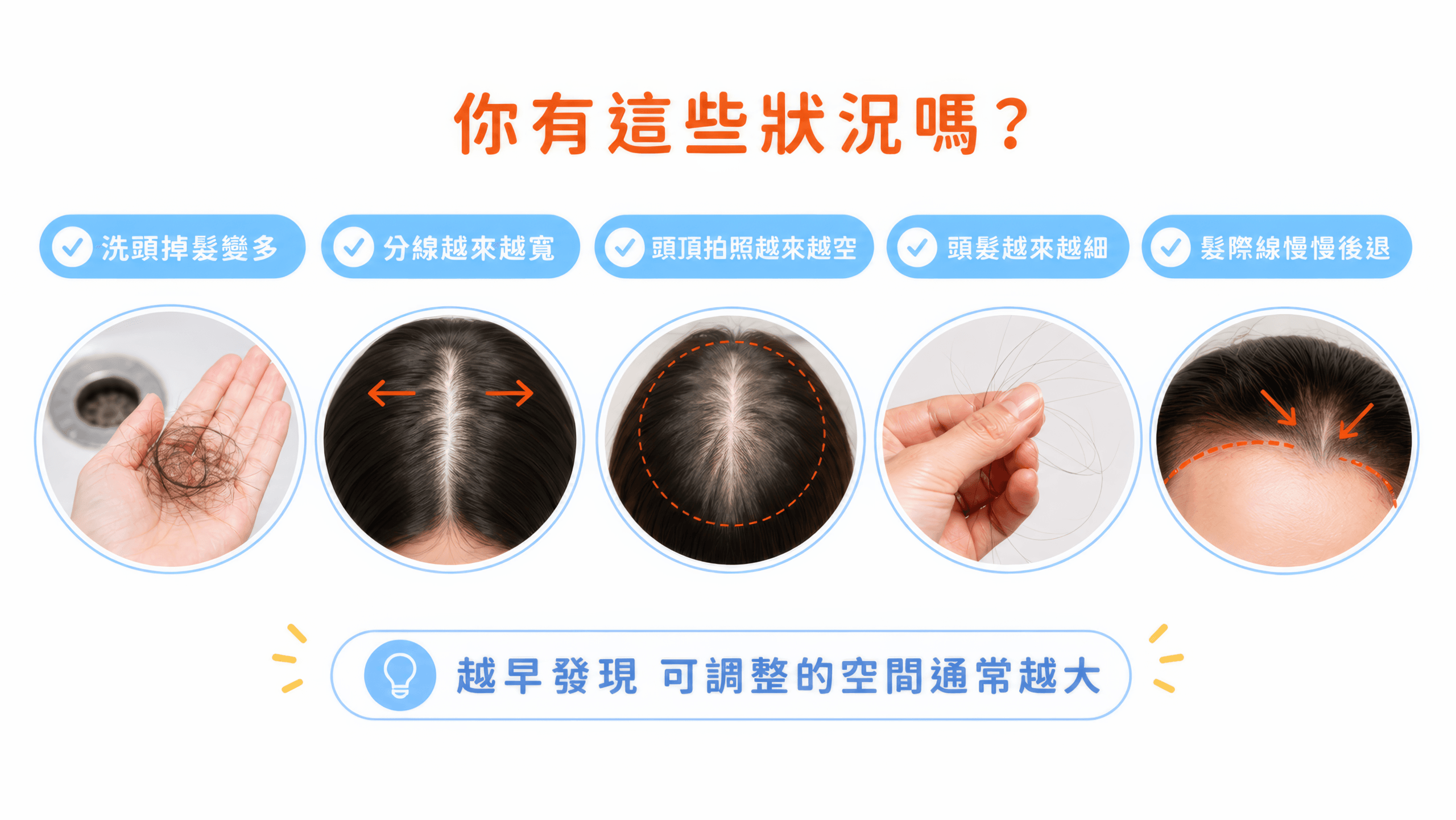 洗頭掉很多頭髮正常嗎 掉髮警訊