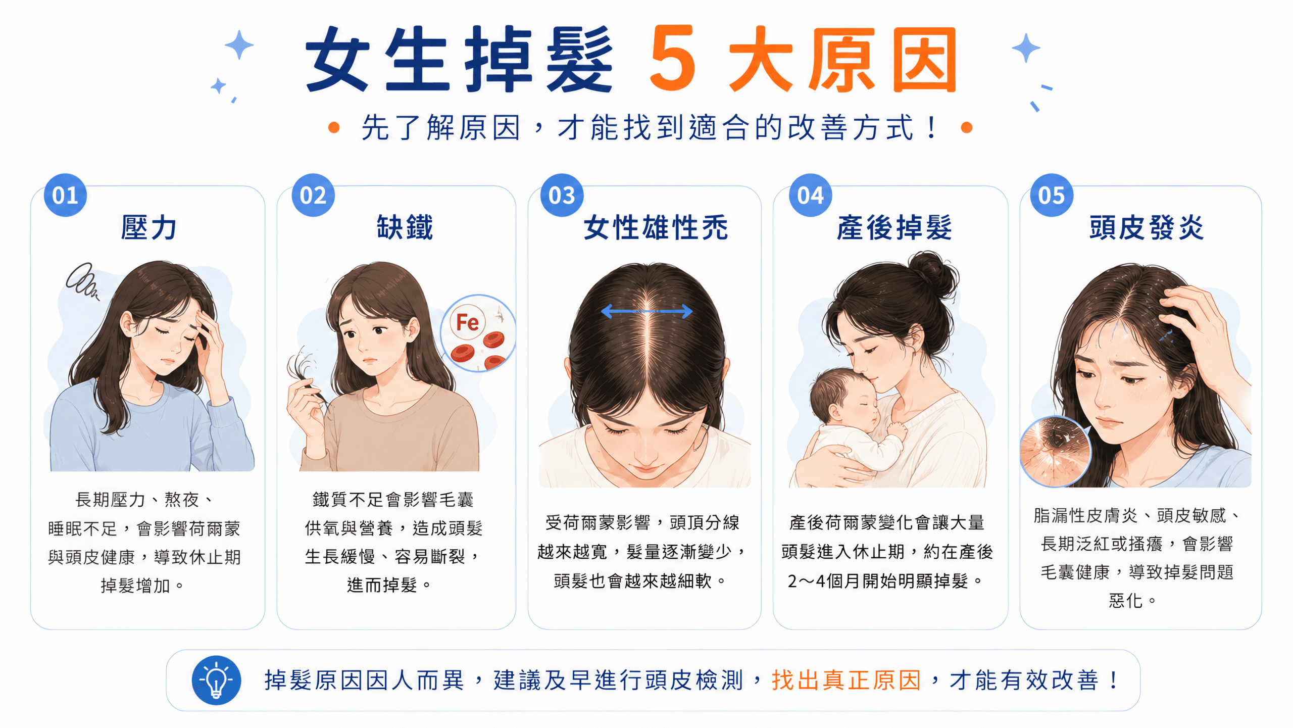 女生掉髮5大原因 女生掉髮5大原因,包括壓力、缺鐵、女性雄性禿、產後掉髮及頭皮發炎。