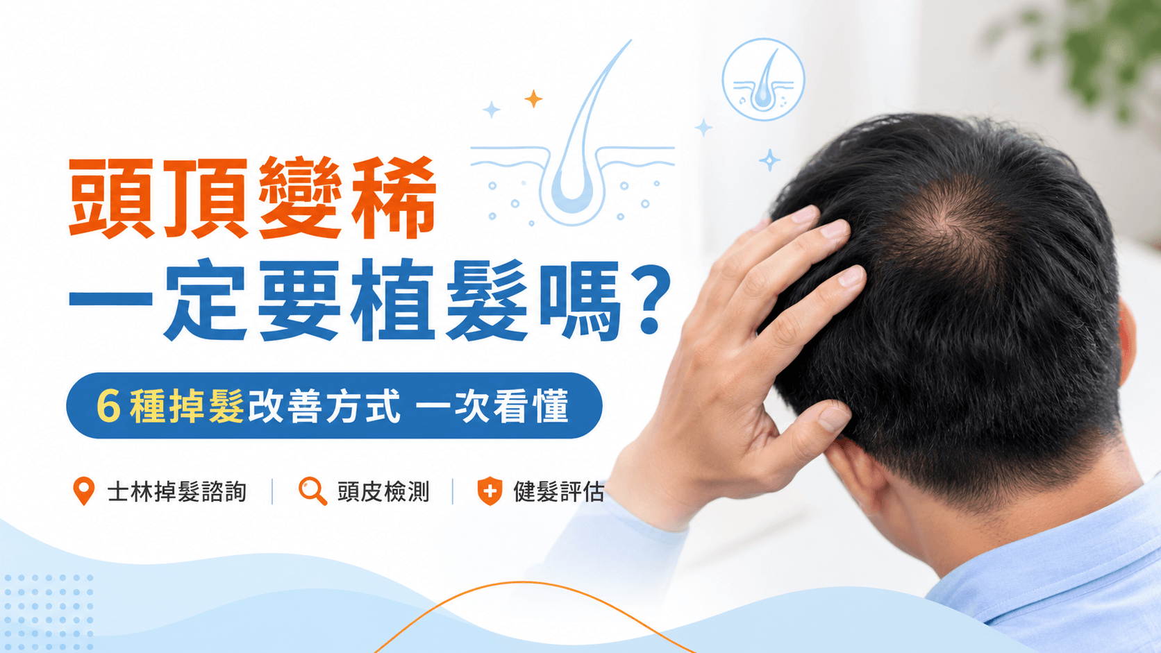 士林掉髮諮詢|頭頂變稀一定要植髮嗎? 士林掉髮諮詢-頭頂變稀一定要植髮嗎