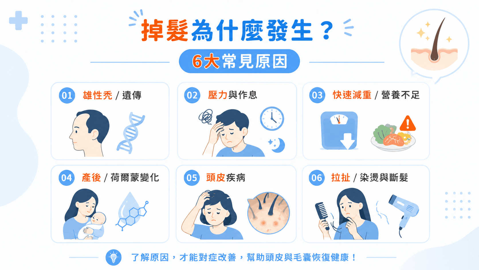 掉髮為什麼發生？雄性禿、壓力、減重、荷爾蒙、頭皮疾病等6大常見原因