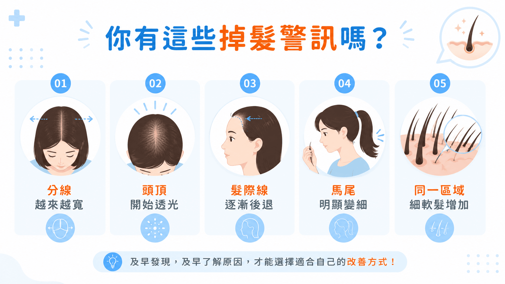 5個常見掉髮警訊|分線變寬、頭頂透光 掉髮警訊包含分線變寬、頭頂透光、髮際線後退、馬尾變細與細軟髮增加