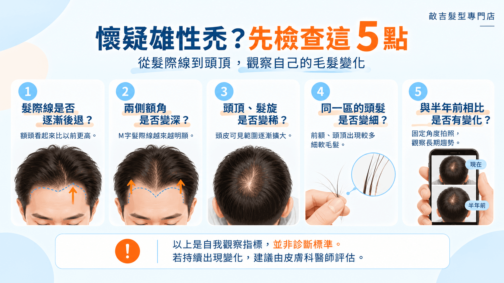 雄性禿初期症狀自我檢查5大重點，包含髮際線後退、額角變深、頭頂變稀、頭髮變細及半年照片比較。